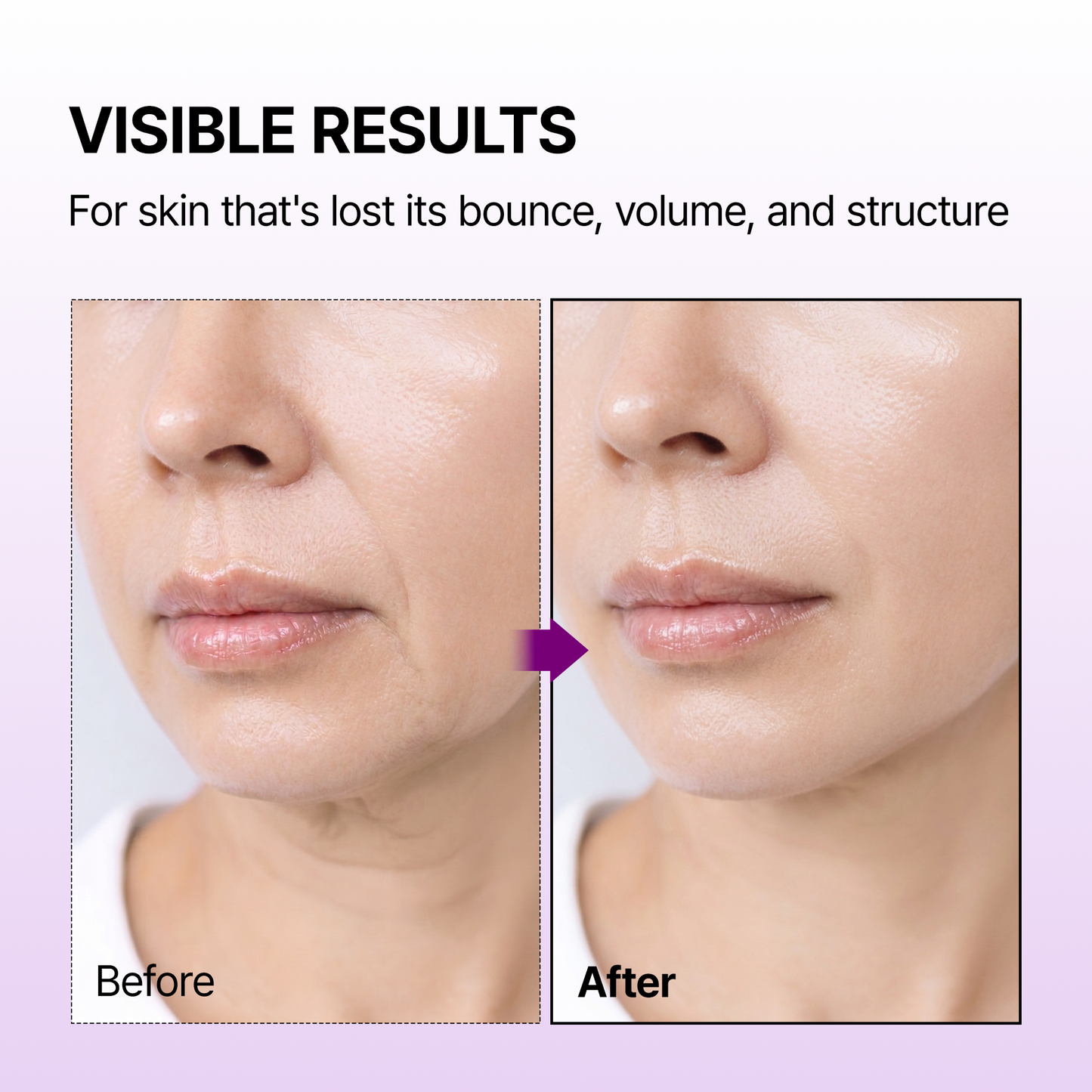 Calcium Bonding Serum & Cream Duo