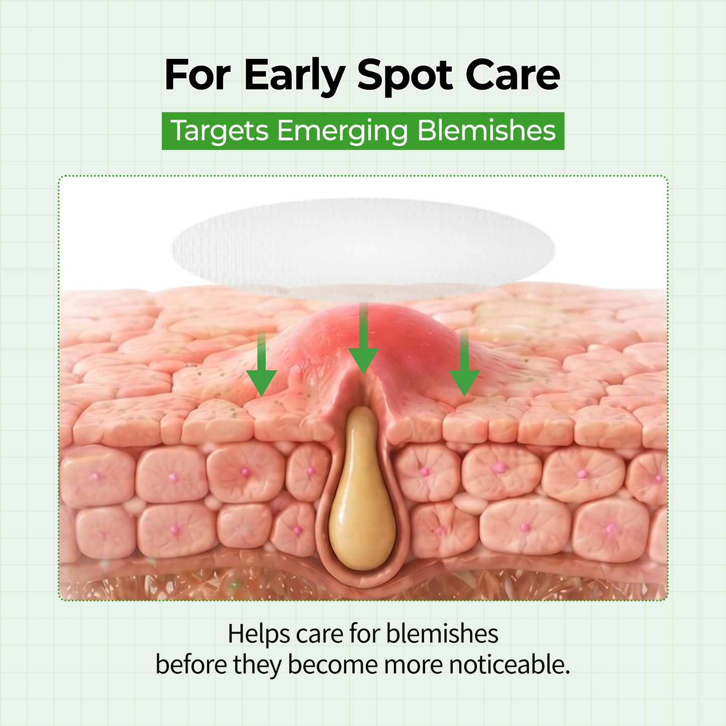 S-ZINC ZERO FIT Ultra Thin Blemish Spot Patch