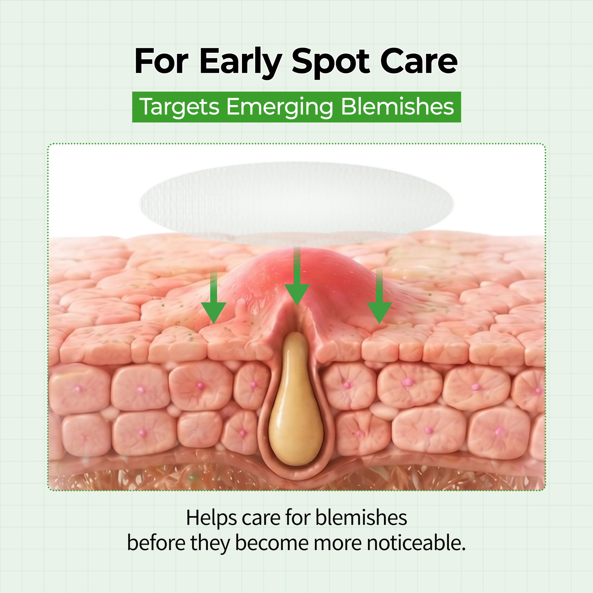 S-ZINC ZERO FIT Ultra Thin Blemish Spot Patch