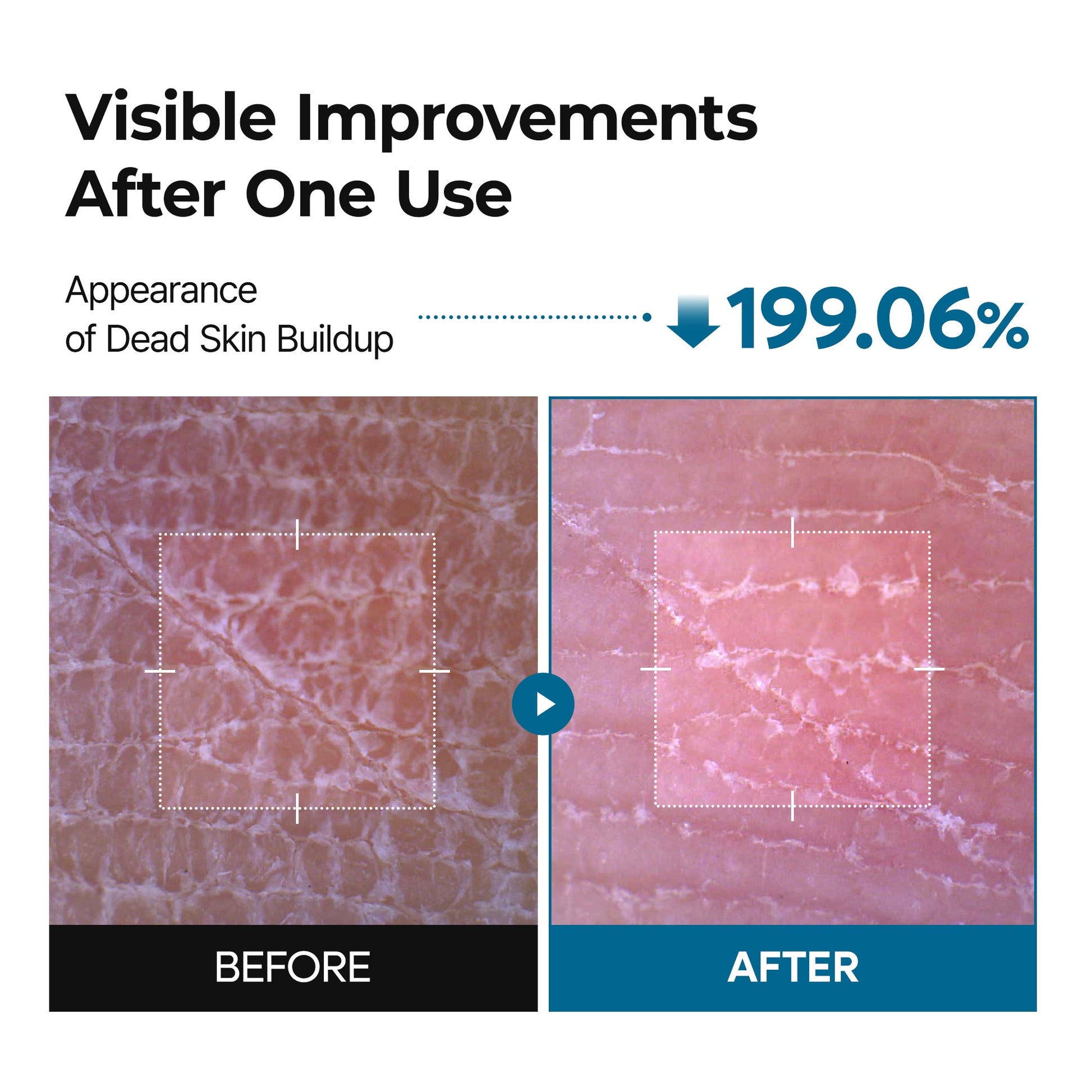 Peel Shot Exfoliating TX Spray