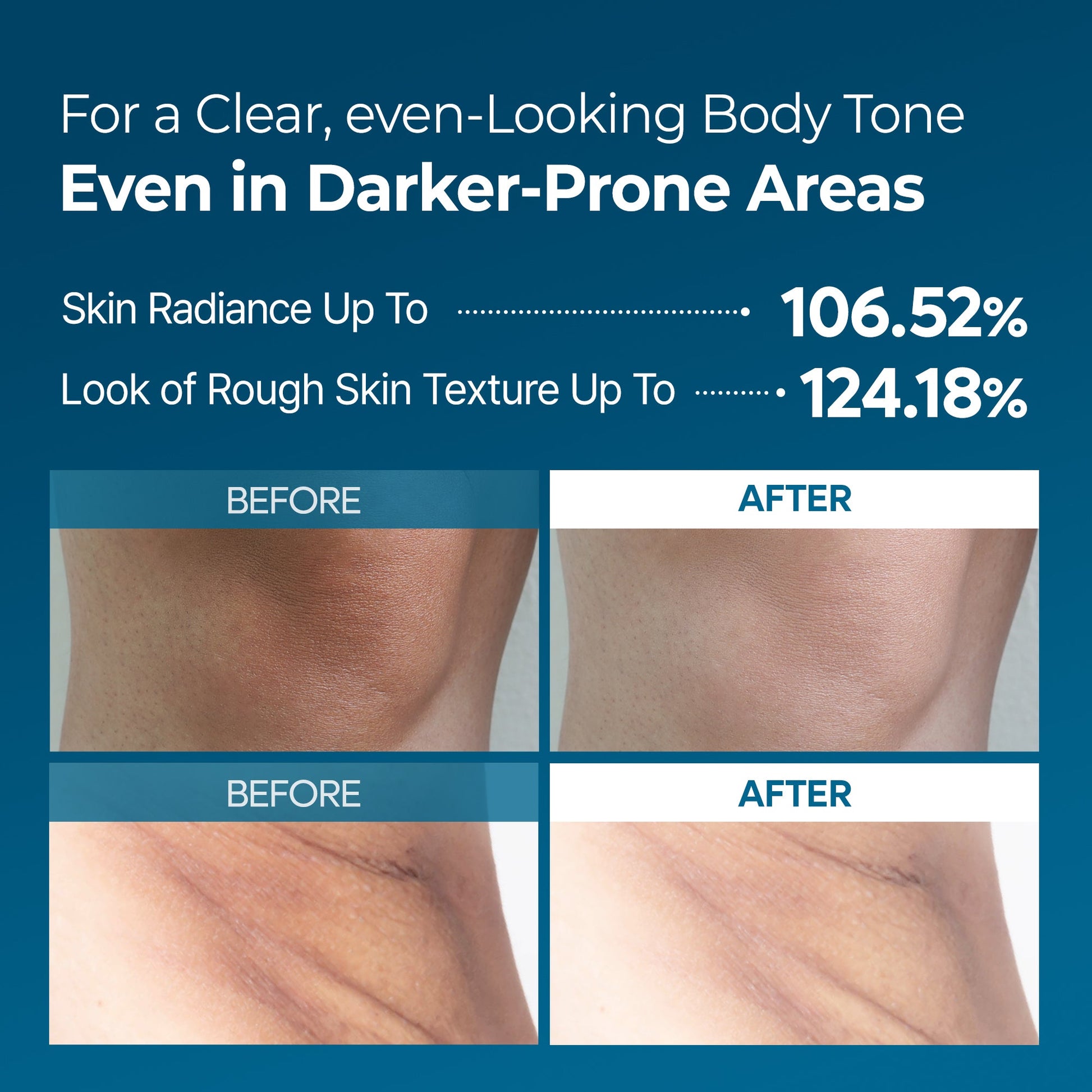 Peel Shot Exfoliating TX Spray